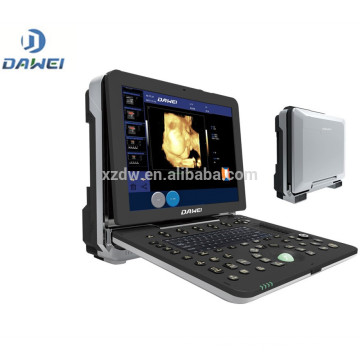 DW-C300 haut de gamme portable 4D fonction doppler couleur machine à ultrasons